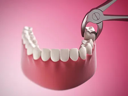 Lake Street Dental | Implant Dentistry, Veneers and Sleep Apnea